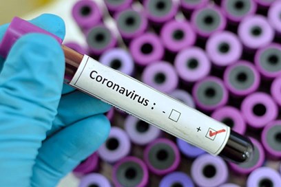 Coronavirus, tornano a salire i contagiati: 276 nuovi casi, di cui 135 in Lombardia